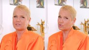 Xuxa passa por cirurgia - Reprodução/Instagram