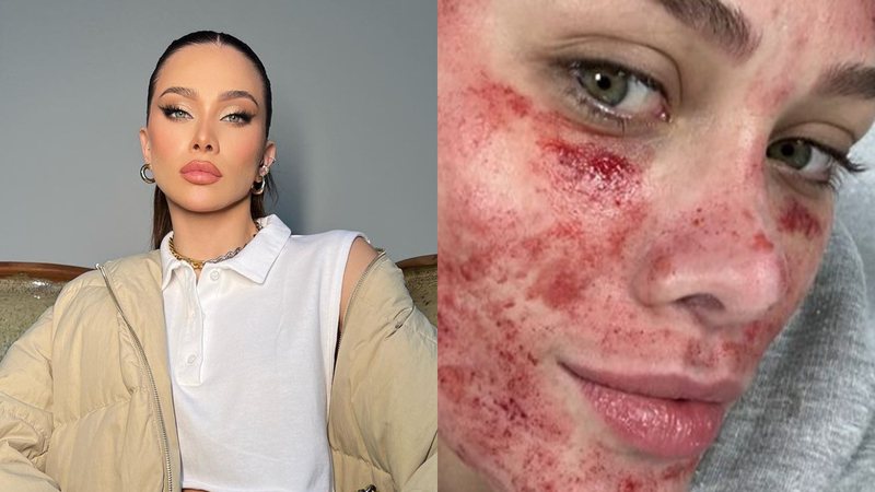 Flávia Pavanelli surpreendeu os fãs ao surgir com o rosto ensanguentado nas redes sociais - Reprodução/Instagram