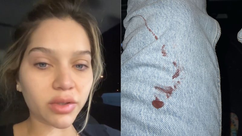 Filha de Leandro sofre fratura e surge com roupa coberta de sangue - Instagram