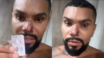 Naldo revela drama após ser obrigado a tomar comprimidinho azul: "Tá batendo no teto" - Reprodução/ Instagram