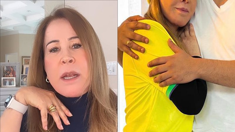 Zilu Camargo surge com rosto deformado e preocupa fãs: "Muitos estão perguntando" - Reprodução/Instagram