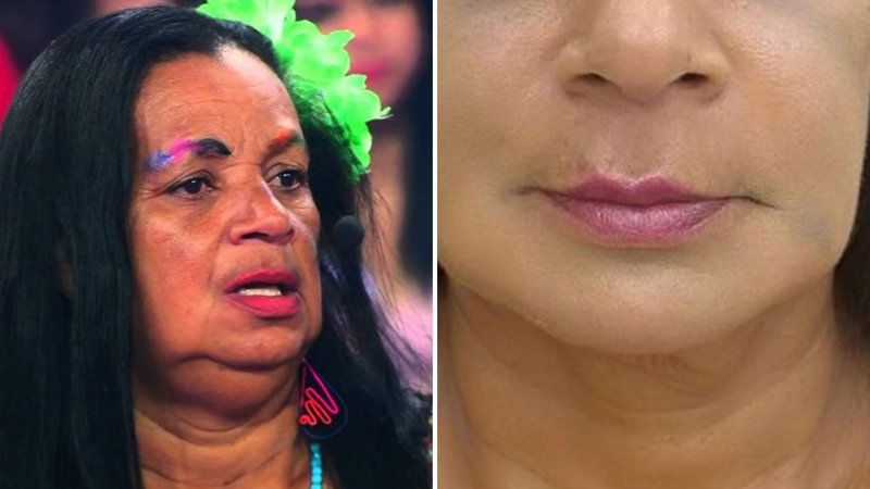 Gaguinha de Ilhéus surge irreconhecível após harmonização facial: "Rejuvenesceu 20 anos" - Reprodução/ Instagram