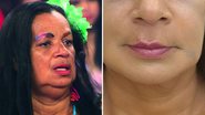 Gaguinha de Ilhéus surge irreconhecível após harmonização facial: "Rejuvenesceu 20 anos" - Reprodução/ Instagram