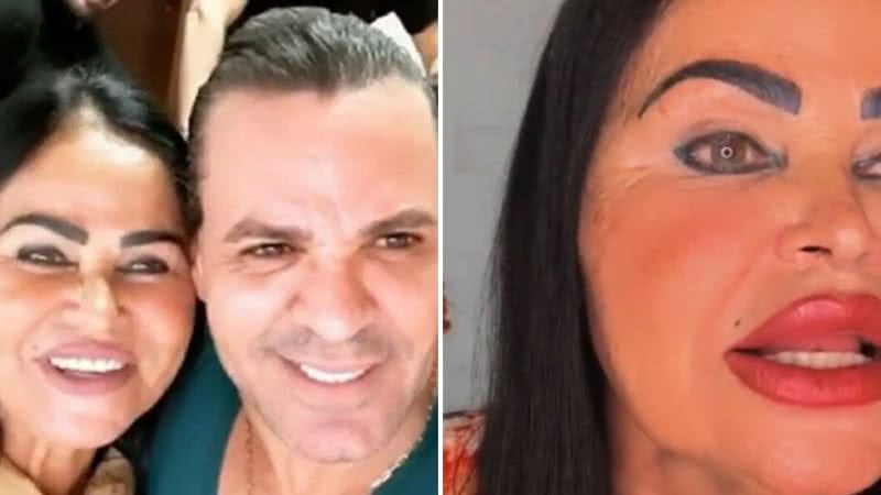 Mãe de Eduardo Costa gera espanto com nova aparência: "O que aconteceu com você?" - Reprodução/Instagram