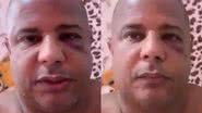 Coagido, Marcelinho Carioca aparece com olho roxo em vídeo: "No cativeiro" - Reprodução/ Instagram