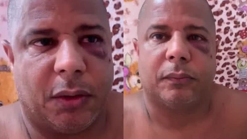 Cantor sai em defesa de sequestrador de Marcelinho Carioca: "Apanhou pouco" - Reprodução/ Instagram