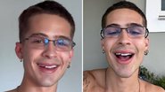 O ator João Guilherme sofre pequeno acidente em Carnaval e perde parte do dente: "Bom?" - Reprodução/Instagram