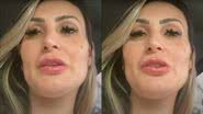 Quem é o pai? Após separação, Andressa Urach suspeita de nova gravidez: "Barriguda" - Reprodução/YouTube