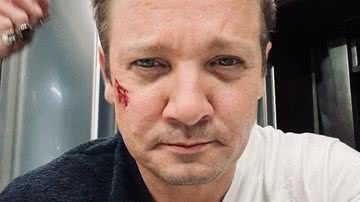 Ator de 'Vingadores', Jeremy Renner sofre acidente e fica em estado grave - Reprodução/Instagram