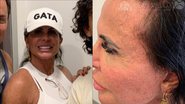 Aos 64 anos, Gretchen sofre com falta de cabelo e expõe calvície: "Autoestima" - Reprodução/Instagram