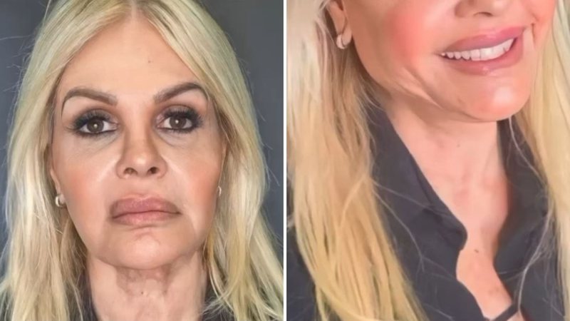 A apresentadora e modelo Monique Evans realiza harmonização facial e resultado surpreende: "Ficou top" - Reprodução/Instagram