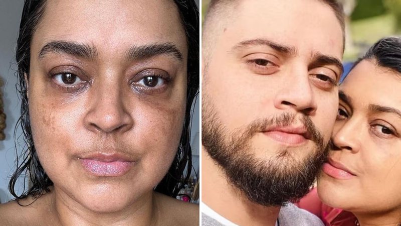 Preta Gil diz que terminou casamento para sobreviver ao câncer: "Instinto" - Reprodução/ Instagram