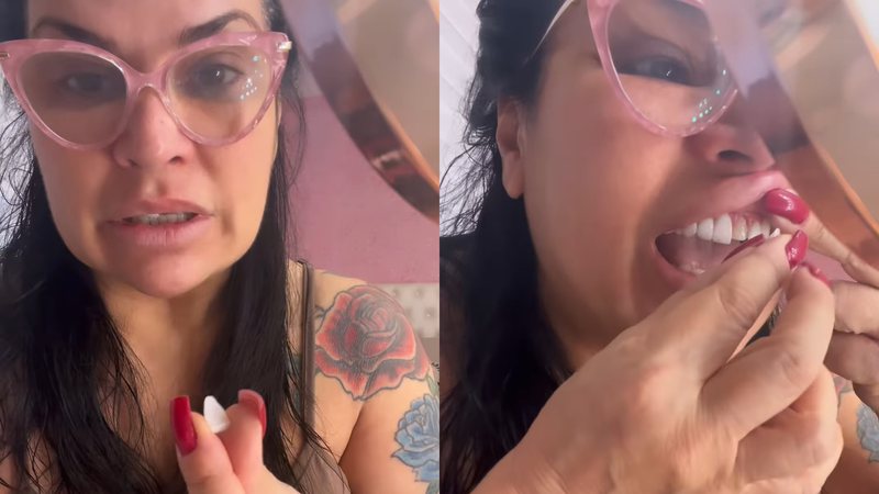 Solange Gomes foi criticada por colar sua lente dentária em casa - Reprodução/Instagram