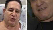 Marrone se choca ao mostrar novo rosto após cirurgias: "Levei um susto" - Reprodução/Instagram/SBT