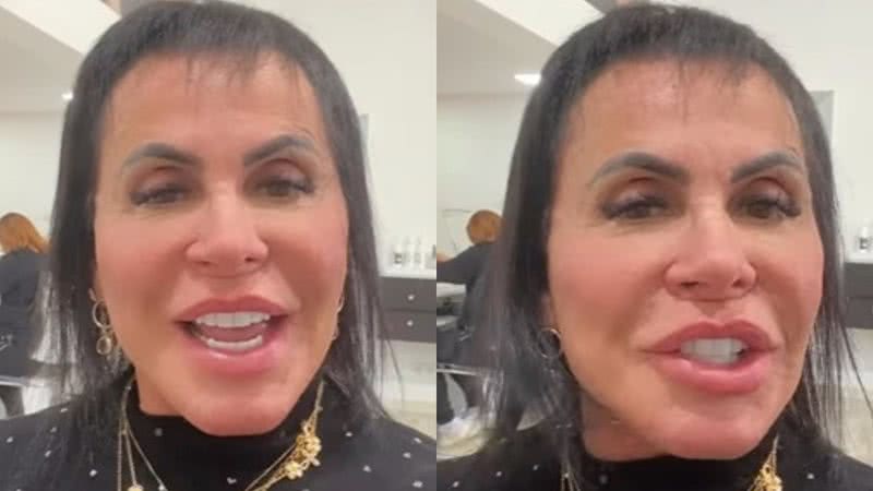 Gretchen choca ao exibir antes e depois de tratamento contra alopecia: "Recuperei" - Reprodução/ Instagram