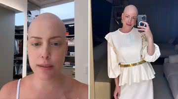 Lutando contra câncer, Fabiana Justus fala sobre a sensação de estar sem cabelo - Reprodução/Instagram