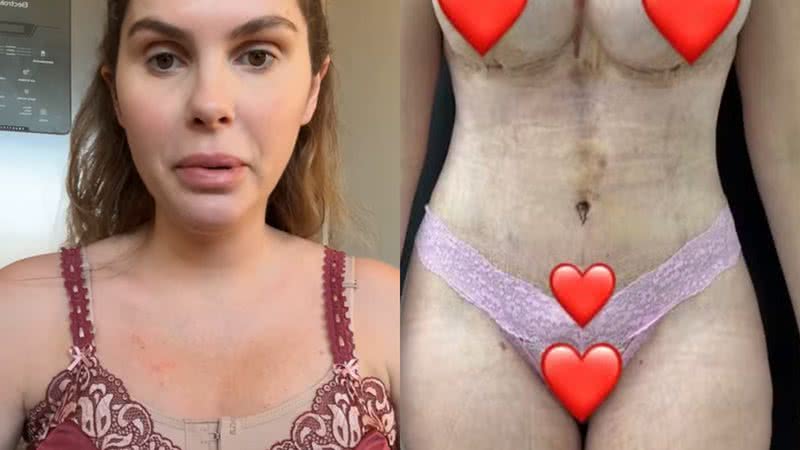 Bárbara Evans exibiu o resultado de suas cirurgias plásticas - Reprodução/Instagram