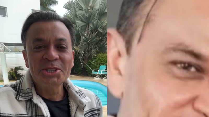 Frank Aguiar exibe antes e depois após nova harmonização facial: “Carinha de 33” - Reprodução/Instagram