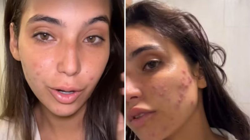 Vanessa Lopes faz check-up no médico e tem descoberta infeliz: "Comprometido" - Reprodução/Instagram