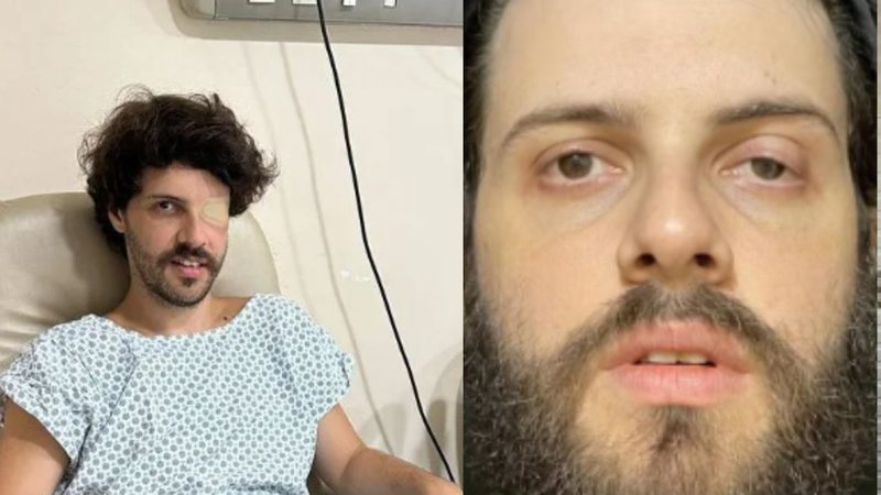 Diogo Defante fala sobre problema de saúde após diagnostico de tumor benigno - Reprodução/Instagram