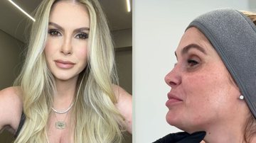 Bárbara Evans revela ter feito novo procedimento estético no rosto - Reprodução/Instagram