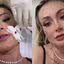 Andressa Urach apanha de Juju Ferrari e é hospitalizada ensanguentada: ‘Vai ter volta’