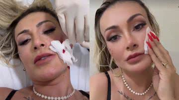 Andressa Urach apanha de Juju Ferrari e é hospitalizada ensanguentada: ‘Vai ter volta’ - Reprodução/Instagram