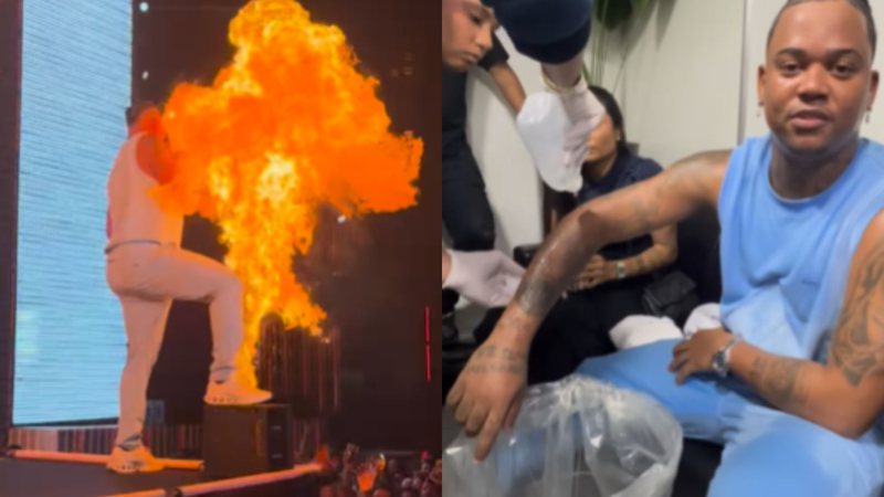 Rapper sofre acidente surpreendente com pirotecnia em show: ‘Vai ter que indenizar!’ - Reprodução/Instagram