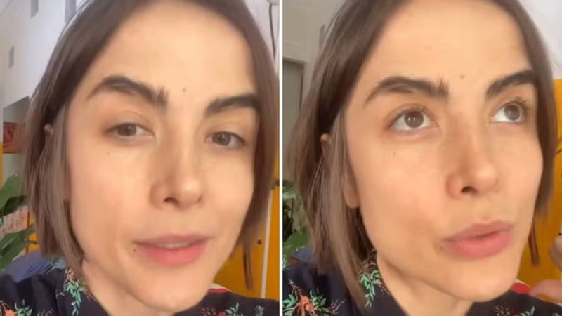 Maria Casadevall diz que passou por cirurgia após descoberta de síndrome rara - Reprodução/ Instagram