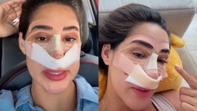 Em recuperação, ex-BBB Deniziane revela custo da rinoplastia: 'Desvio de sépto' - Reprodução/Instagram