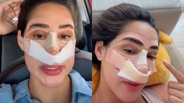 Em recuperação, ex-BBB Deniziane revela custo da rinoplastia: 'Desvio de sépto' - Reprodução/Instagram