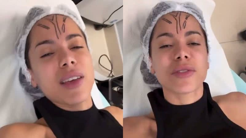 Anitta publica vídeo ‘doidona’ antes de realizar procedimento: ‘remédio batendo’ - Reprodução/Instagram