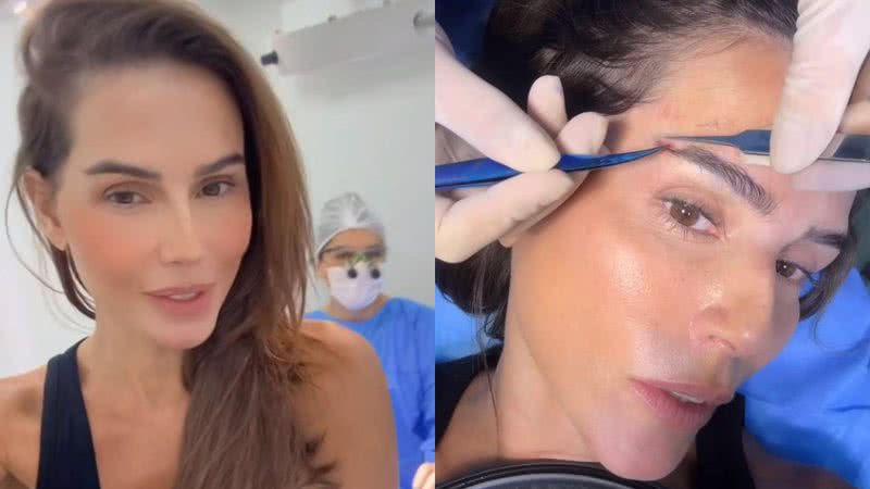 Deborah Secco antes e durante o transplante de sobrancelha, nesta segunda-feira, 2 - Reprodução/Instagram