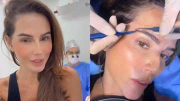 Deborah Secco antes e durante o transplante de sobrancelha, nesta segunda-feira, 2 - Reprodução/Instagram