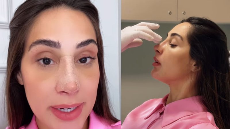 Ex-BBB Deniziane celebra resultado de rinoplastia após queixas: 'Encantada' - Reprodução/Instagram