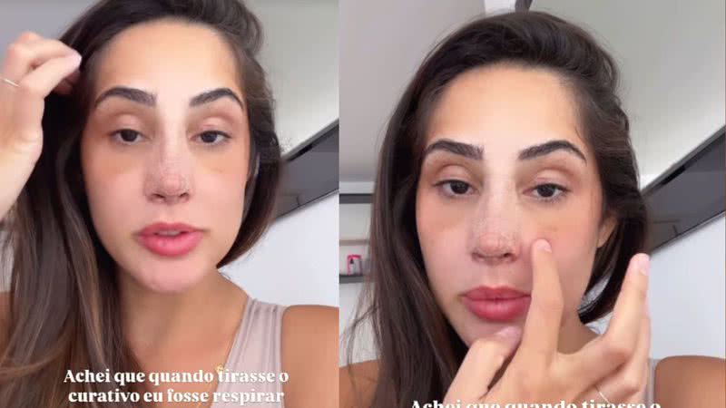 Deniziane atualiza fãs sobre recuperação de rinoplastia: 'Voltar a respirar' - Reprodução/Instagram