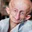 O que é progeria? Jovem de 19 anos morreu após doença do envelhecimento precoce