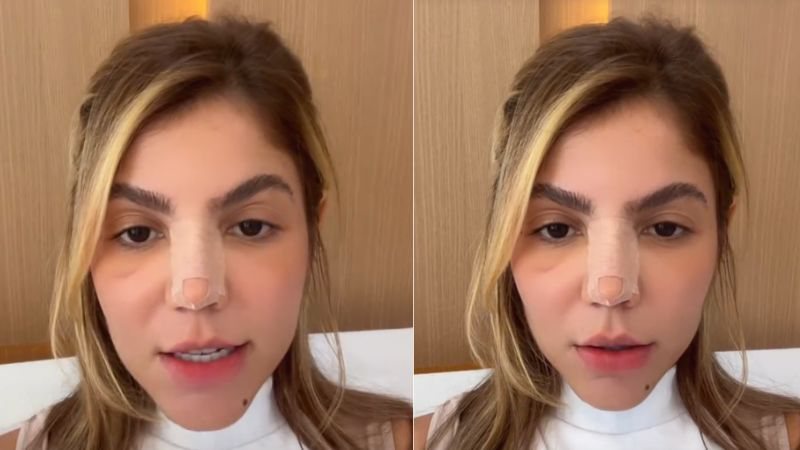 Hariany Almeida desabafa sobre comentários que recebia em relação à sua aparência; influenciadora realizou rinoplastia na última semana - Reprodução/Instagram