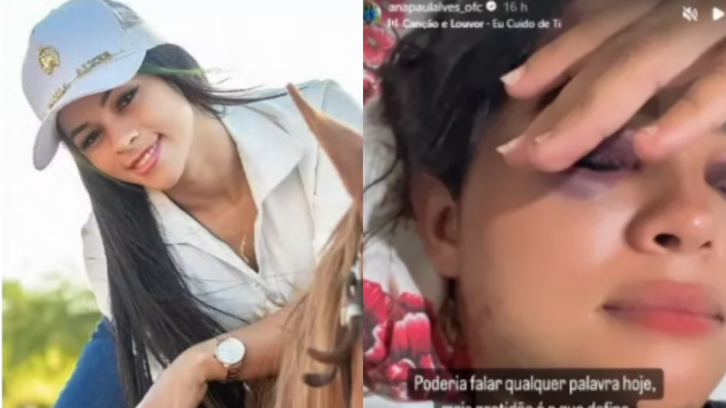 Influenciadora é espancada com taco de sinuca no Ceará; ex-marido é suspeito - Reprodução/ Instagram