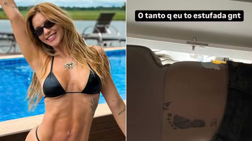 Virginia Fonseca exibe antes e depois de cirurgia para hérnia umbilical - Reprodução/ Instagram