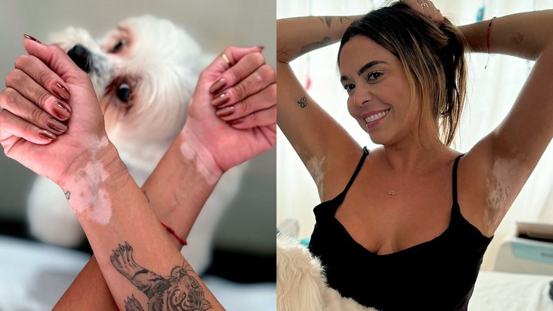 Marília Pinheiro fala sobre diagnóstico de vitiligo e aceitação: 'Faz parte de quem sou' - Reprodução/Instagram