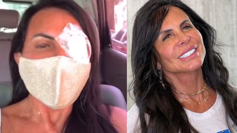 Gretchen passa por cirurgia de emergência problema oftalmológico: "Estou de tampão" - Reprodução/Instagram