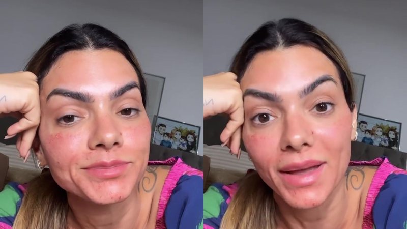 Aos 39 anos, Kelly Key revela idade que começou a fazer botox: "É preventivo" - Reprodução/Instagram