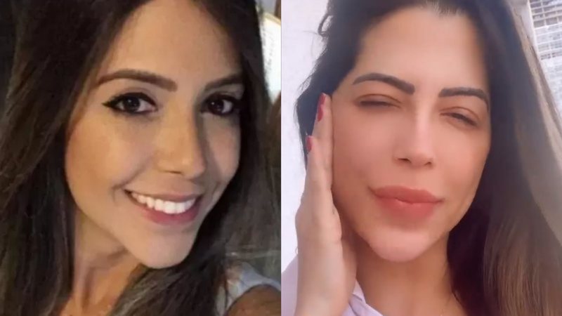 Ex-BBB Laís se irrita com fotos antes e depois de harmonização: "Vergonha nenhuma" - Reprodução/Instagram