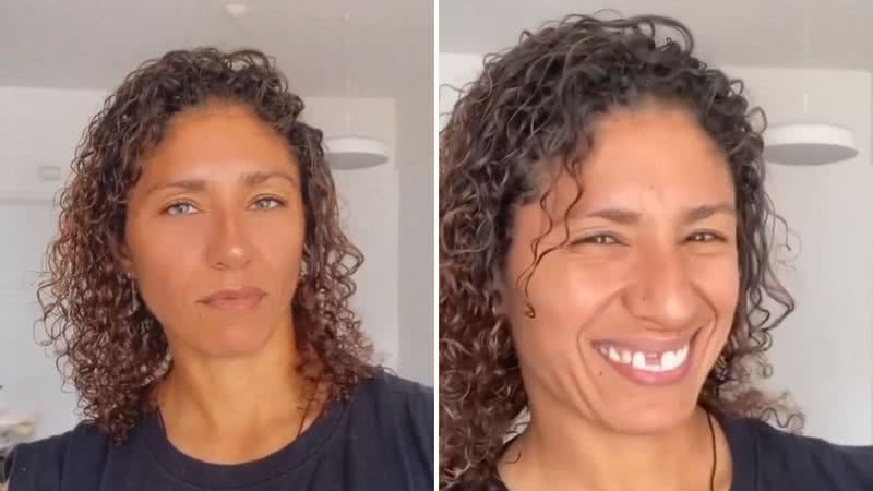 Cristiane Rozeira reforma o sorriso após ficar banguela em partida de futebol: "De volta" - Reprodução/Instagram