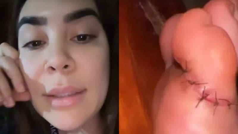 Naiara Azevedo preocupou os fãs ao contar que pisou em uma faca e precisou levar pontos - Reprodução/Instagram