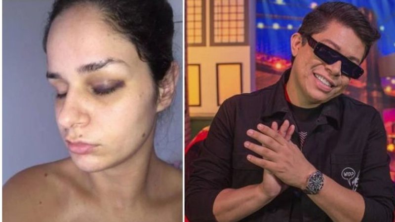 Mulher de DJ Ivis se diz 'aliviada' após denunciar agressões e tranquiliza público: "Estou segura" - Reprodução/Instagram