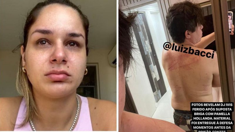 Pâmela Hollanda se revolta ao ver imagens de DJ Ivis com hematomas: "Nunca vi ele assim" - Reprodução/Instagram