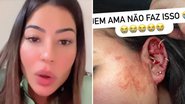 Influenciadora choca fãs ao aparecer ensanguentada após agressão: "Eu não mereço" - Reprodução/Instagram