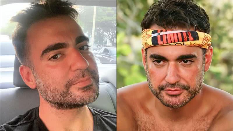 Ex-No Limite Matheus Pires mostra marcas da varíola dos macacos no rosto: "Isolado" - Reprodução/Instagram